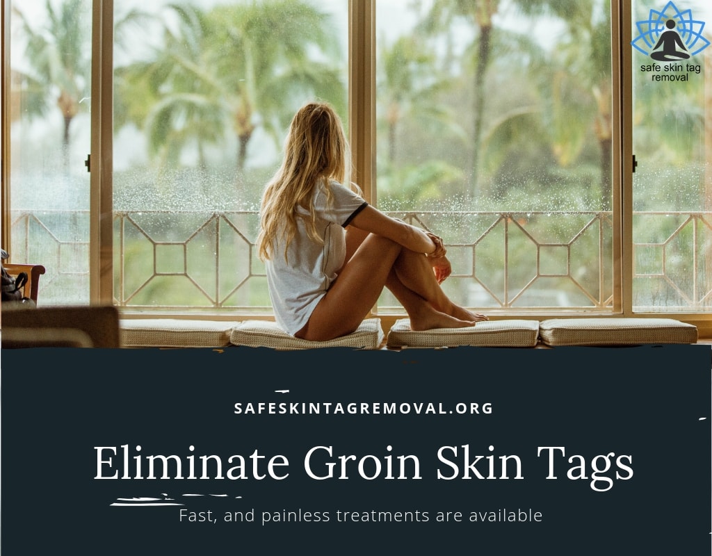 Eliminate Skin Tags On Groin And Inner Thigh Today Skin Tag Removal