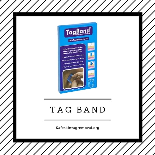 tag-band-skin-tags-on-penis
