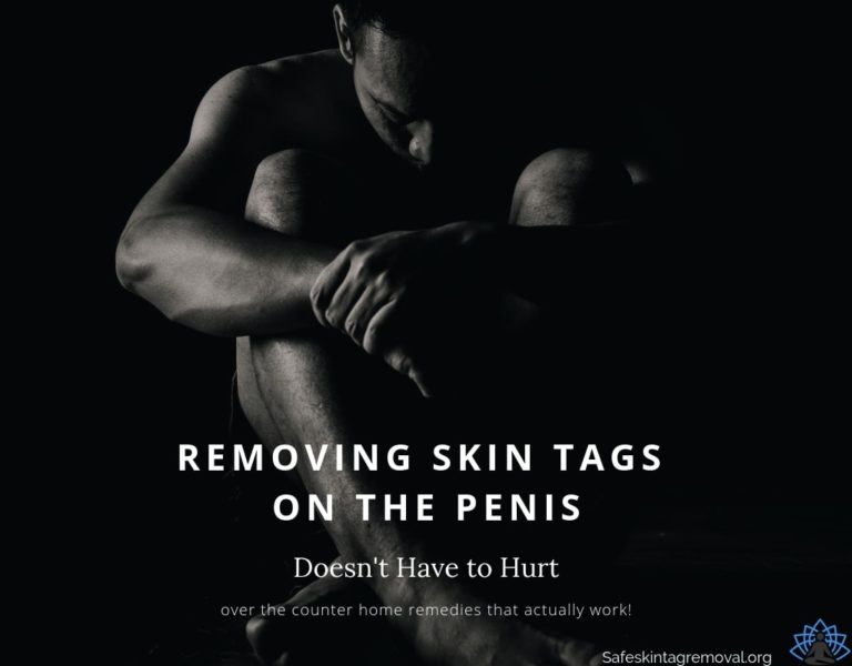skin-tags-on-penile-shaft